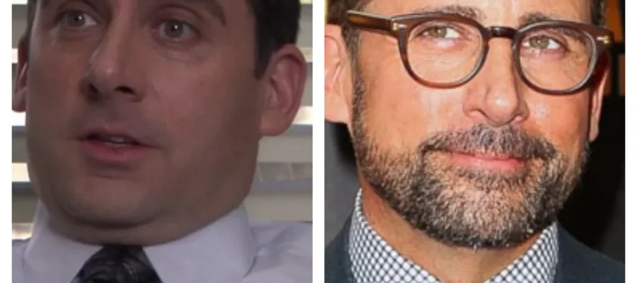 steve carell hair transplant