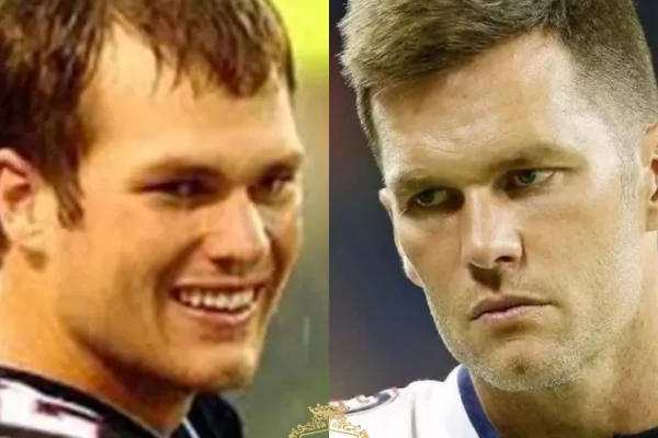 Gerüchte über eine Haartransplantation bei Tom Brady: Was ist bestätigt und was ist Spekulation?