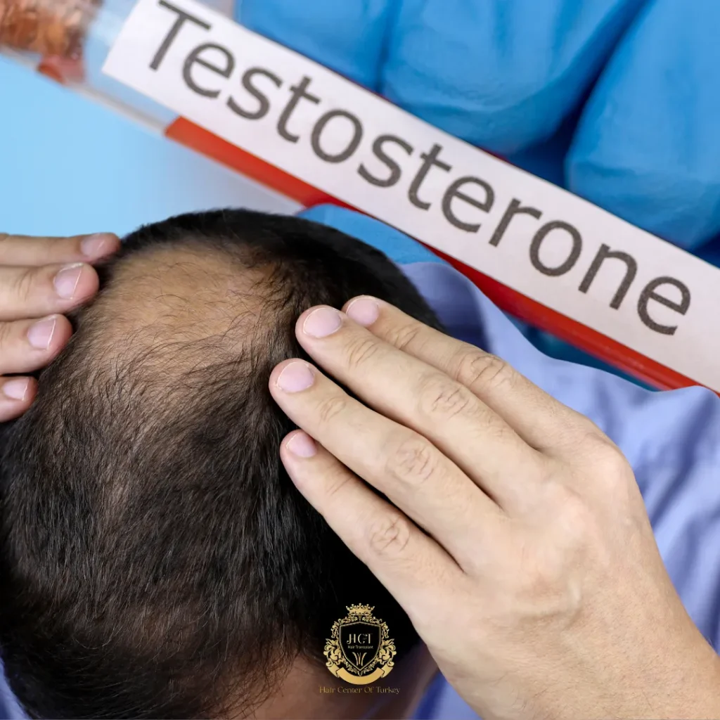 TRT y caída del cabello