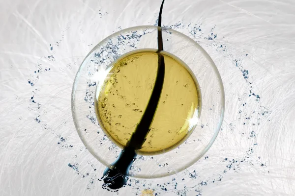 Anatomia do folículo piloso e foliculite