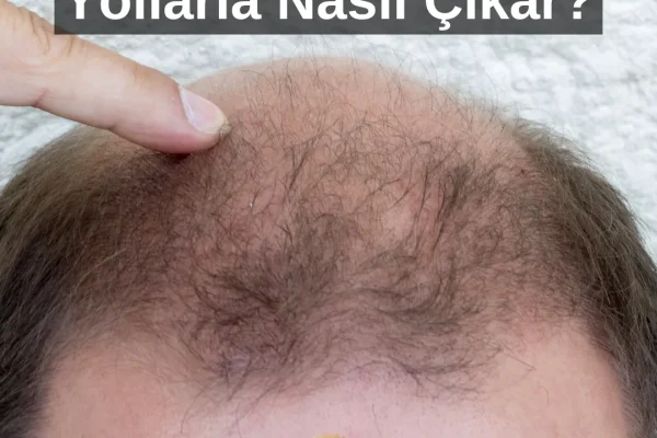 Como fazer o cabelo crescer novamente naturalmente em 3 semanas?