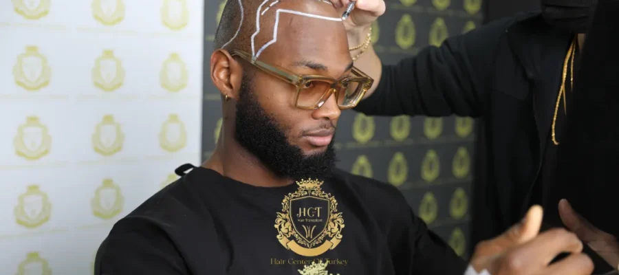 Greffe de cheveux afro