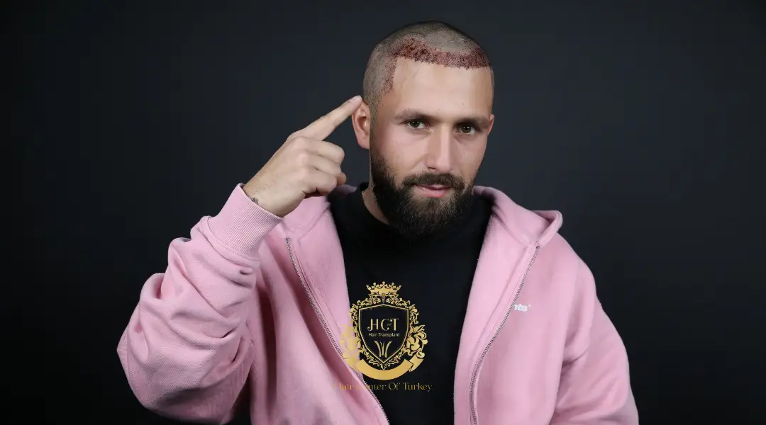 Après le premier lavage post-greffe