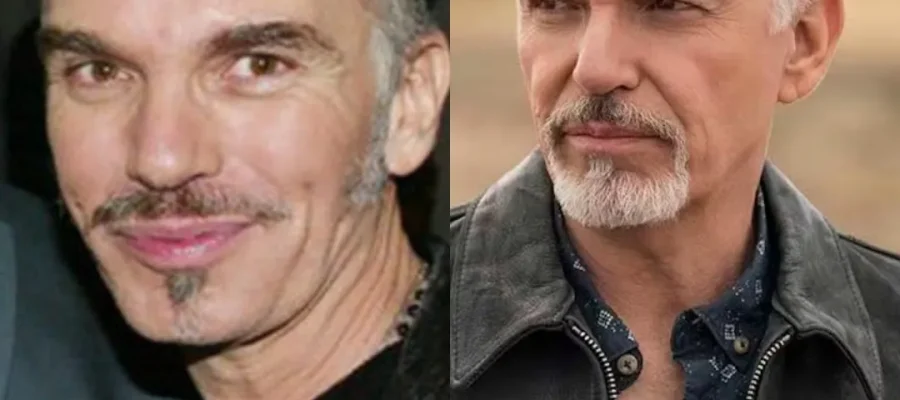 Billy Bob Thornton Hair Transplant