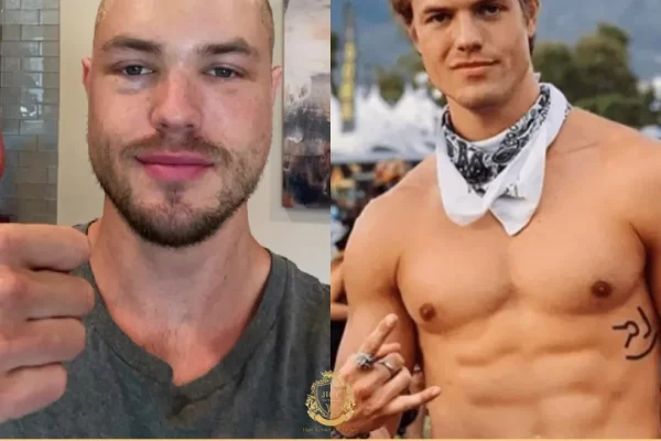 Brett Maverick Haartransplantation