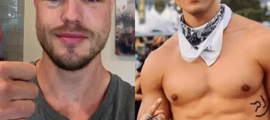 Brett Maverick Hair Transplant|Brett MaveriCK