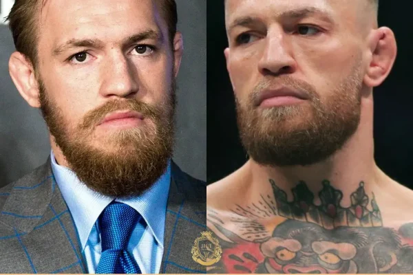 Conor McGregor Haartransplantation
