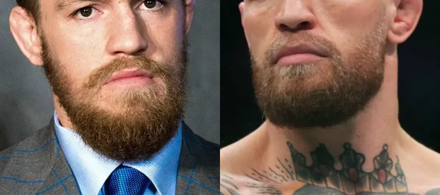 Conor Mcgregor Hair Transplant|Conor Mcgregor Saç Ekimi