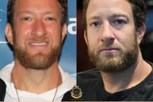 Dave Portnoy Haartransplantation: Was Ist Passiert, Wo Und Was Ist Zu Erwarten?