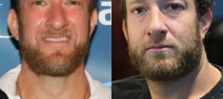 DAVE PORTNOY BEFORE & AFTER