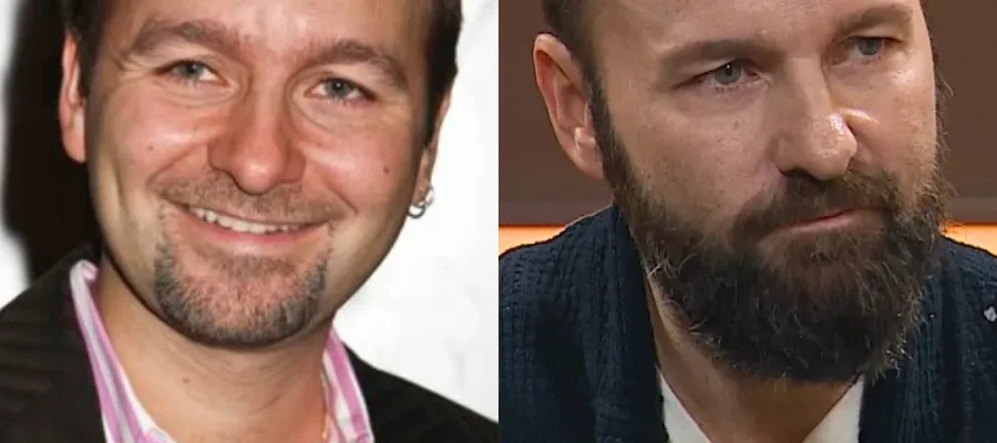 Daniel Negreanu Saç Ekimi