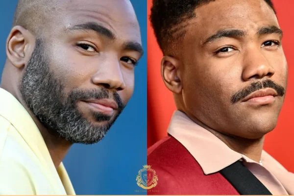 Donald Glover Haartransplantation