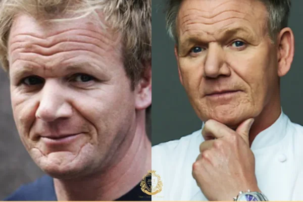 Gordon Ramsay Saç Ekimi