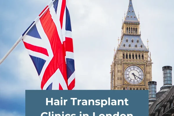 Haartransplantationskliniken in London: Die besten Chirurgen, Kosten & Verfahren erklärt