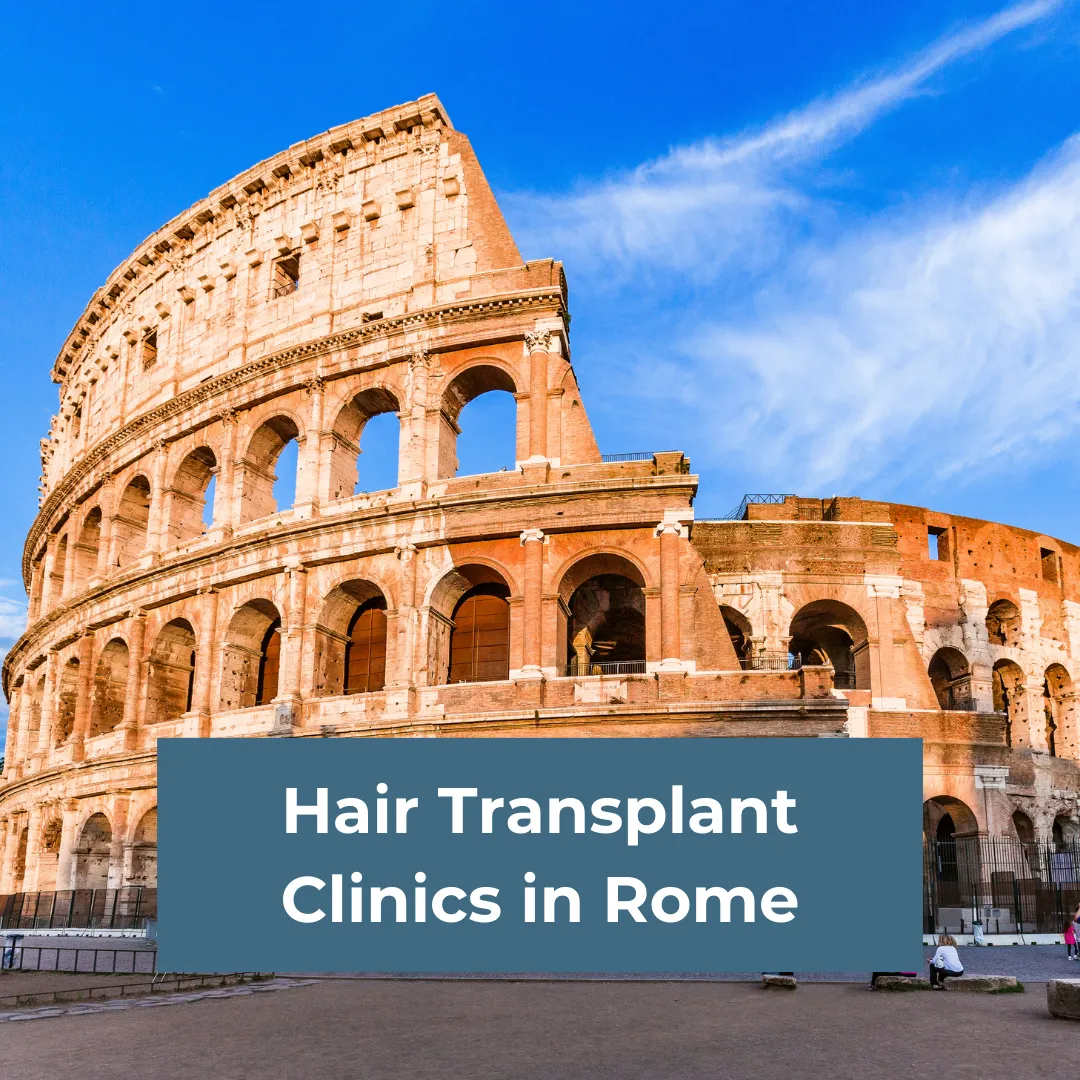 Haartransplantation Kliniken in Rom - Beste Haartransplantation Chirurgen, Kosten & Verfahren erklärt 1 Hair Transplant Clinics in Rome