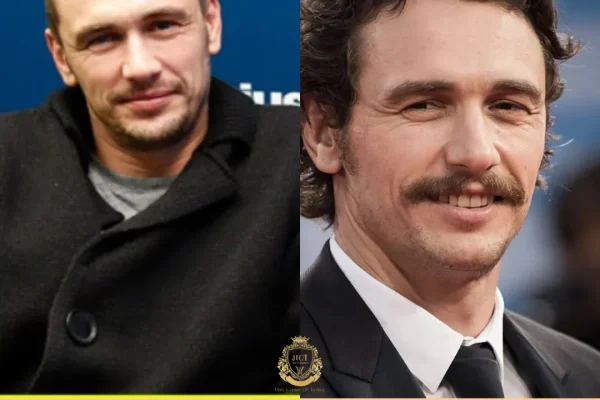 James Franco Saç Ekimi