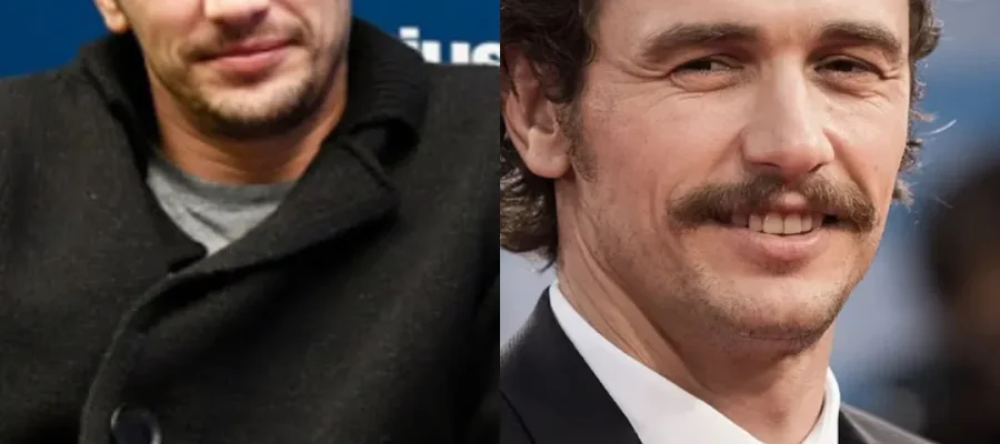 James Franco Hair Transplant|James Franco Saç Ekimi