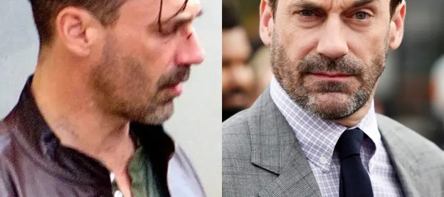 Jon Hamm Hair Transplant