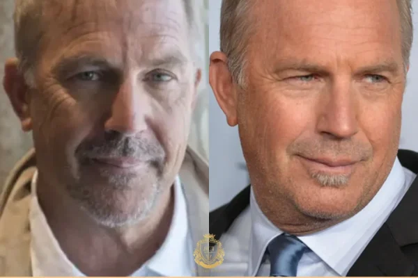 Kevin Costner Haartransplantation