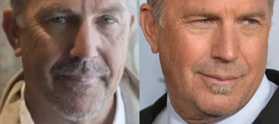 Kevin Costner Hair Transplant Before and After|Kevin Costner Saç Ekimi Öncesi ve Sonrası
