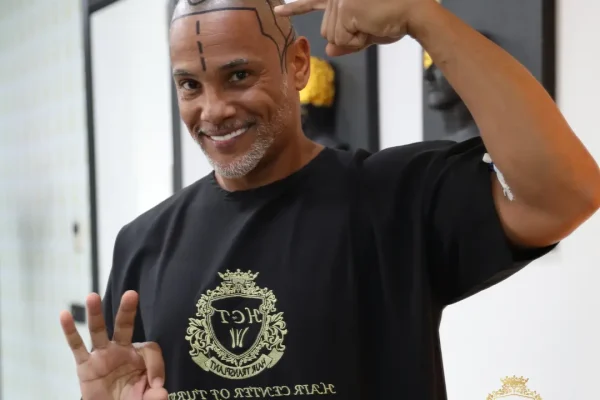 Für wen ist eine Haartransplantation nicht geeignet?