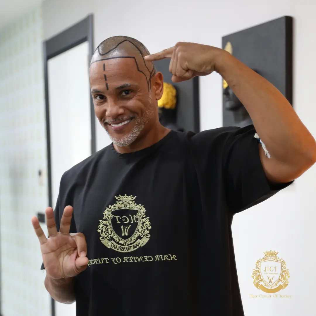 Für wen ist eine Haartransplantation nicht geeignet?