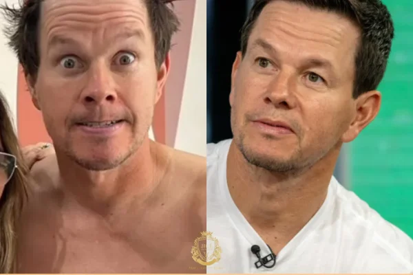 Mark Wahlberg Haartransplantation