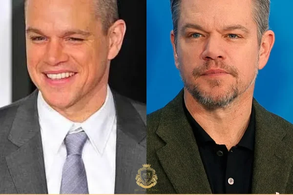 Matt Damon Haartransplantation