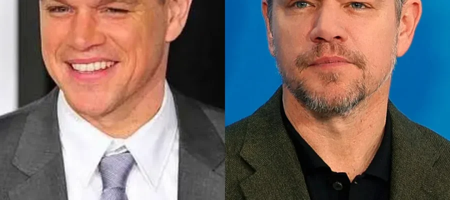 Matt Damon Hair Transplant