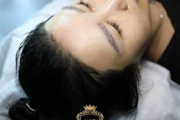 Mikro FUE Kaş Nakli Nedir?