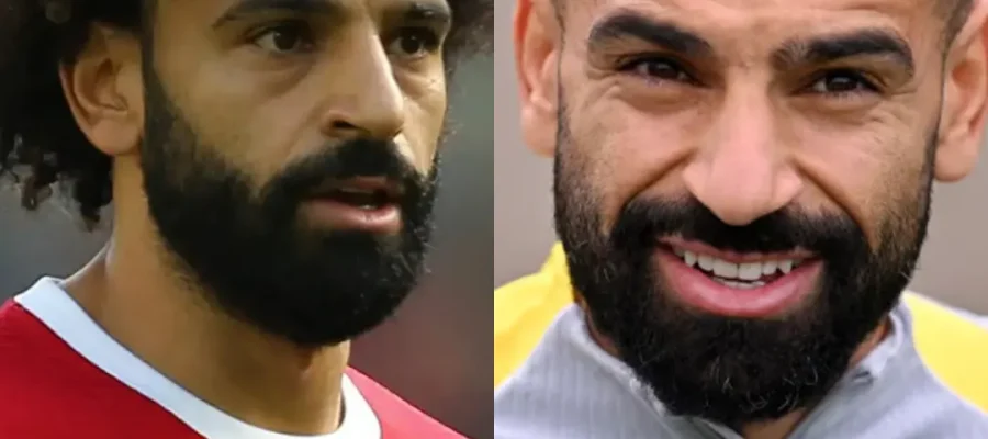 Mohamed Salah Saç Ekimi Öncesi ve Sonrası