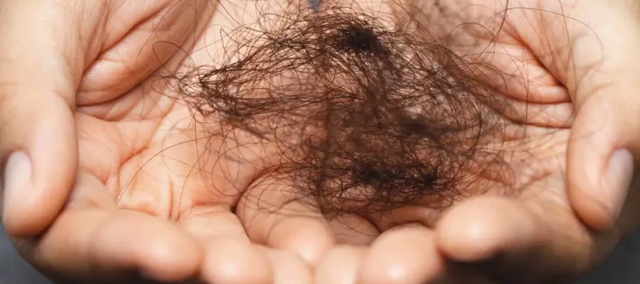 Pourquoi est-ce que je perds autant de cheveux ?