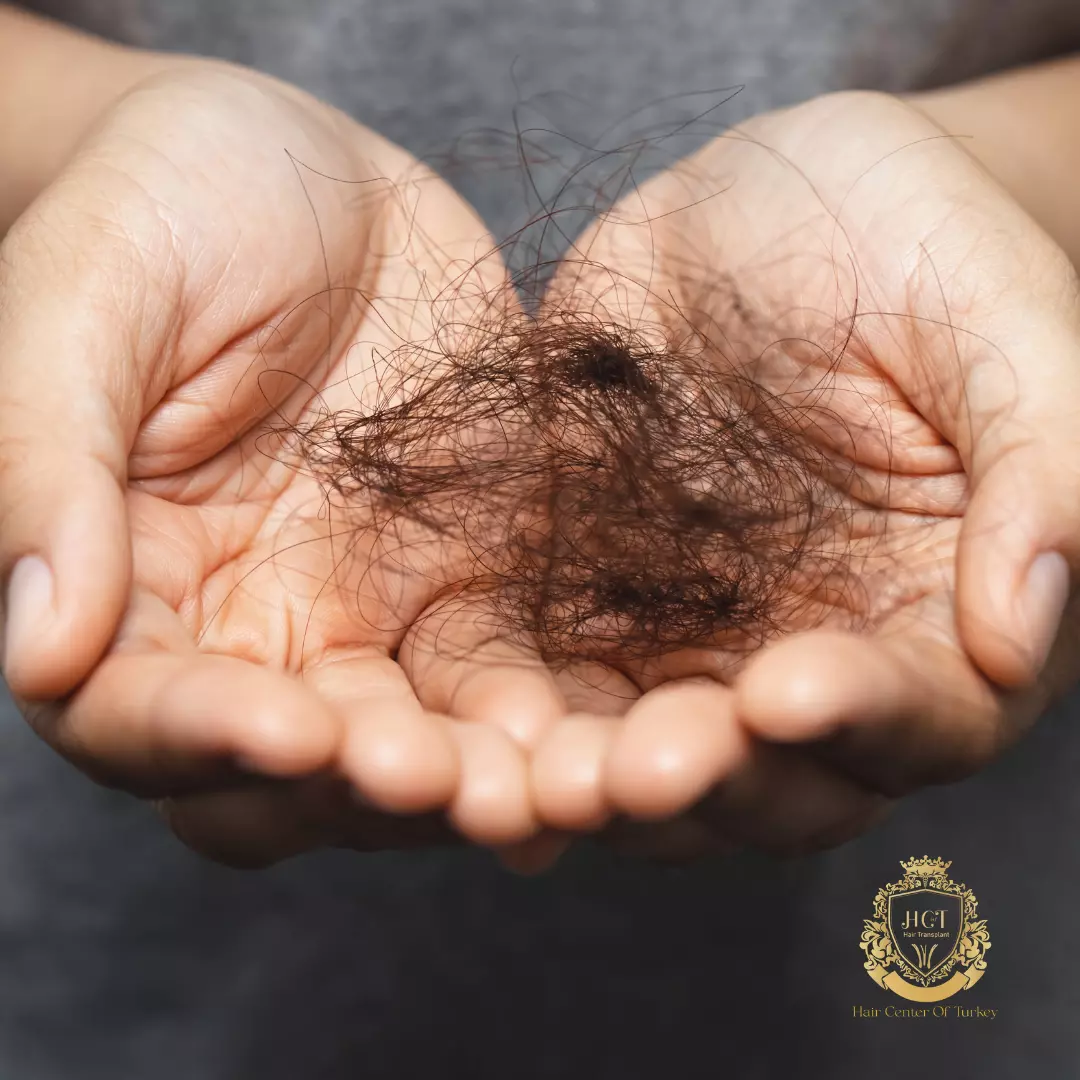 Pourquoi est-ce que je perds autant de cheveux ?