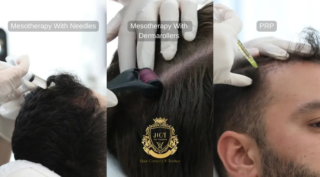 Traitements complémentaires post-opératoires greffe cheveux