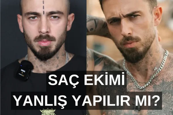 Misslungene Haartransplantation