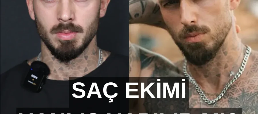 Fehlgeschlagene Haartransplantation|WIRD DIE HAARTRANSPLANTATION FALSCH DURCHGEFÜHRT?