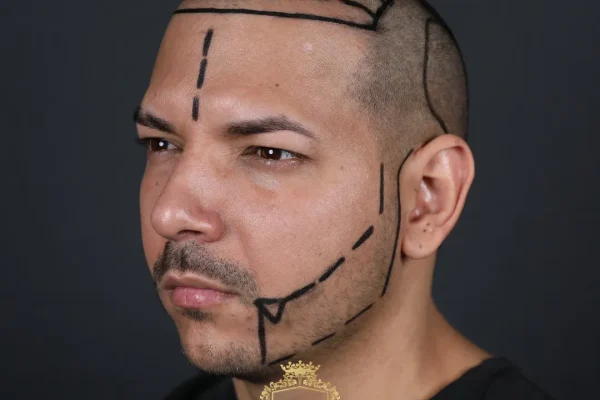 Sakal Ekimi İçin En İyi Mevsim Ne Zaman?