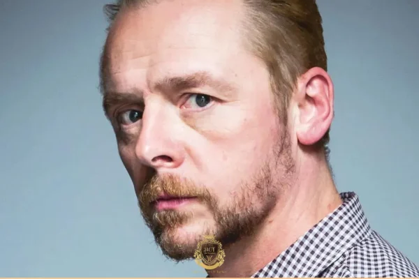 Simon Pegg Haartransplantation
