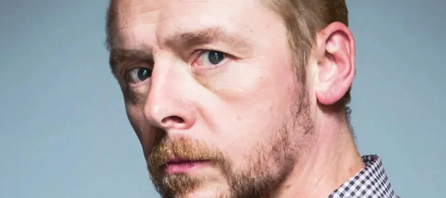 Simon Pegg Hair Transplant