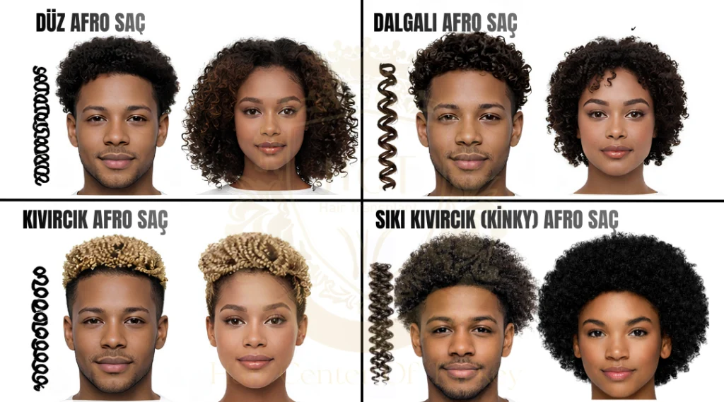 Afro Saç Ekimi 5 Afro Saç Tipleri