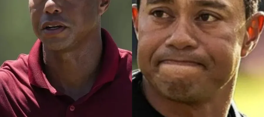 Tiger Woods Hair Transplant