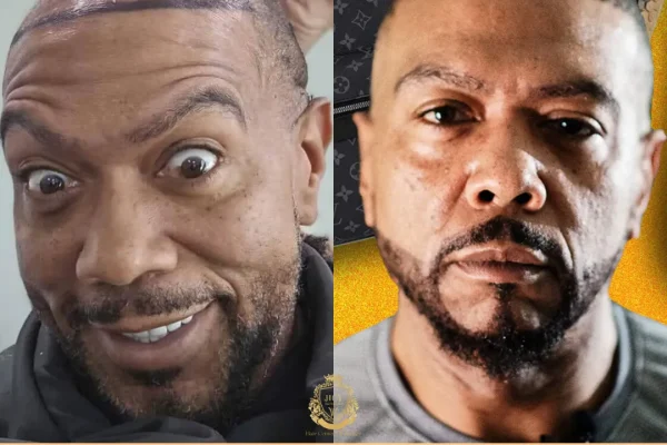 Timbaland Saç Ekimi