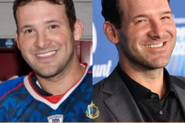 Tony Romo Haartransplantatie