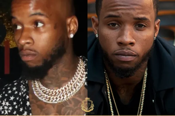 Tory Lanez Haartransplantation