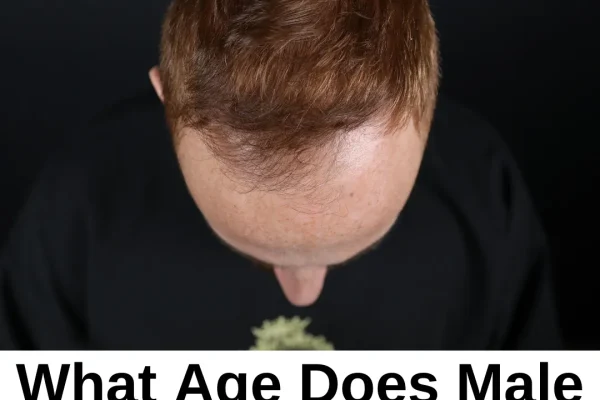 In welchem ​​Alter beginnt der erblich bedingte Haarausfall bei Männern?