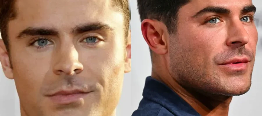 Zac Efron Hair Transplant