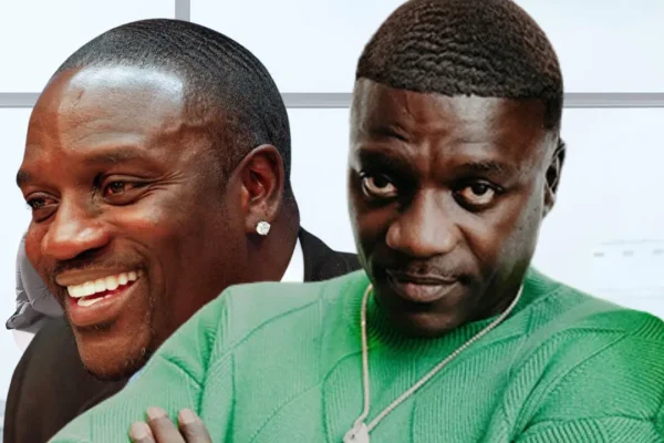 Akon’s Haartransplantationsreise: Was Er Über Die Türkei, Die Kosten Und Die Ergebnisse Erzählte