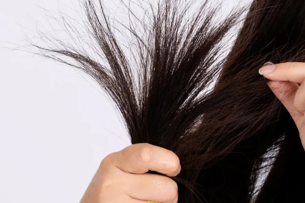 Spröder Haarausfall vs. Haarausdünnung: Die Unterschiede verstehen