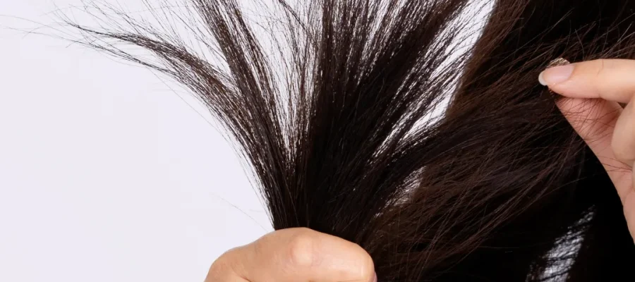 brittle hair and hair thinning