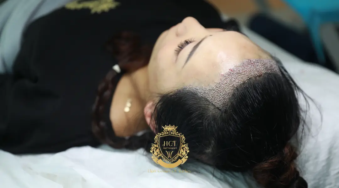 dhi women hair transplant